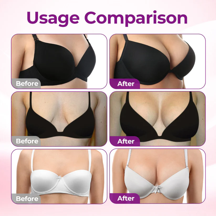Targeted Breast Enhancement Advanced Nano Microneedle Patch