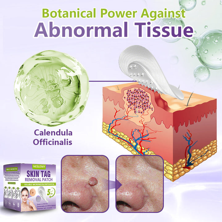 Soluble Microneedle Botanical Skin Tag Removal Patch